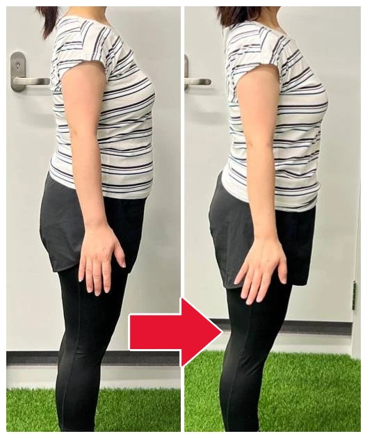 お客様の変化の写真（側面）