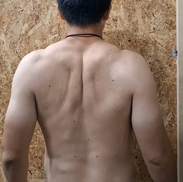 肩甲骨内転の写真